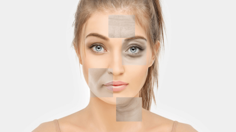 O que é "Ozempic Face" e por que isso ocorre? Separando o fato da ficção