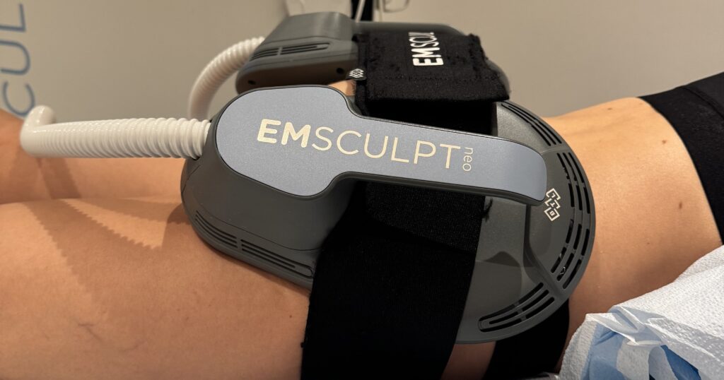 Eu tentei emsculpt neo para um elevador de bunda: veja fotos