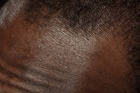 Por que sua pele reage quando você muda o clima e como cuidar dela P – MYXCAPE